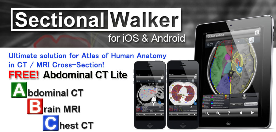 Sectional Walker for iPad & iPhone